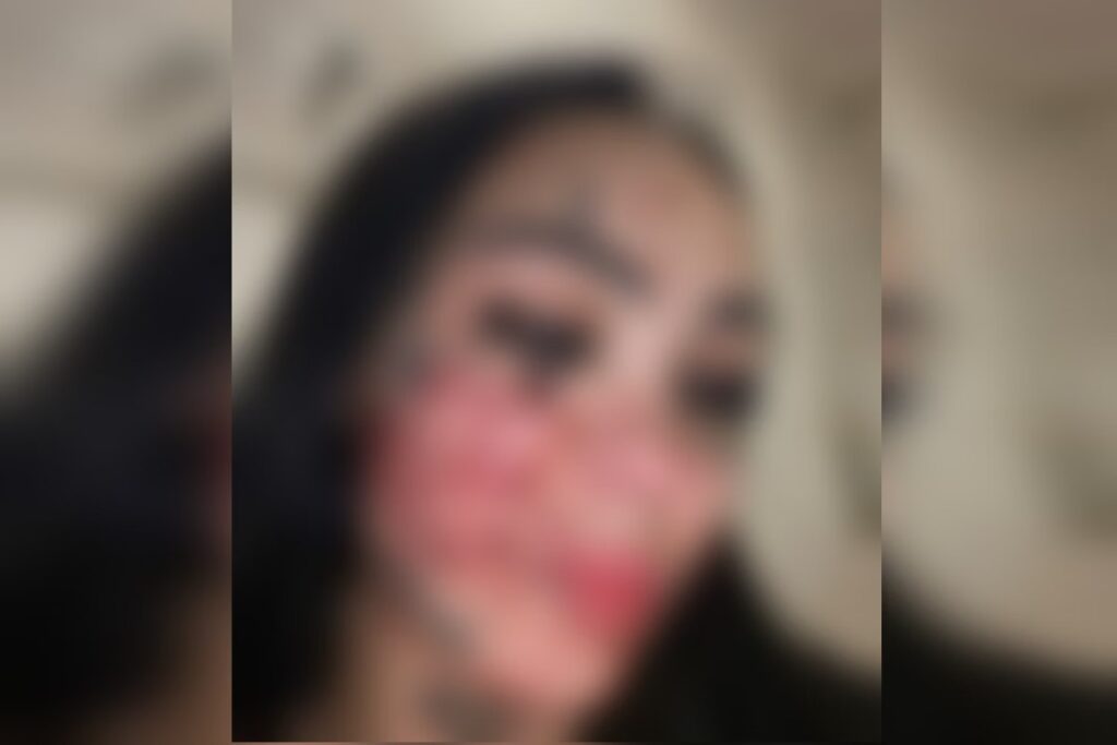 f2d3647d059971968a6a949490639557-1024x683 Influencer brasiliense mostra onde levou 9 facadas do ex durante live.